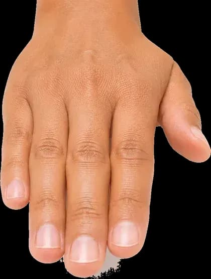 Mão vista de cima, com as unhas em primeiro plano